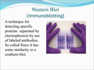 Western Blot
(Immunoblotting)
A technique for
detecting specific
proteins separated by
electrophoresis by use
of labeled a...