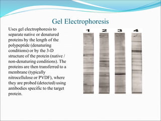 Gel Electrophoresis
Uses gel electrophoresis to
separate native or denatured
proteins by the length of the
polypeptide (de...