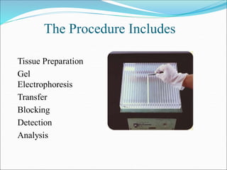 The Procedure Includes
Tissue Preparation
Gel
Electrophoresis
Transfer
Blocking
Detection
Analysis
 