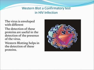 Western Blot a Confirmatory test
in HIV Infection
The virus is enveloped
with different
The detection of these
proteins ar...