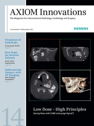 AXIOM Innovations
      The Magazine for Interventional Radiology, Cardiology and Surgery




      Issue Number 14 | November 2011




Treatment of
Endoleaks
Using syngo iGuide
Page 26


New Hope
for Stenotic
Patients
Aortic Valve
Implantation
Page 38


Endovascular
Surgery with
3D Imaging
New Imaging
Possibilities
Page 42




                                        Low Dose - High Principles
                                        Saving Dose with CARE and syngo DynaCT
 
