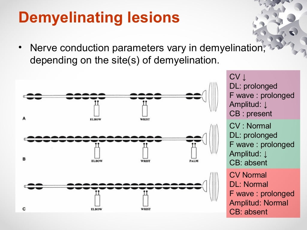 Nerves conduction study, Axonal loss vs Demyelination