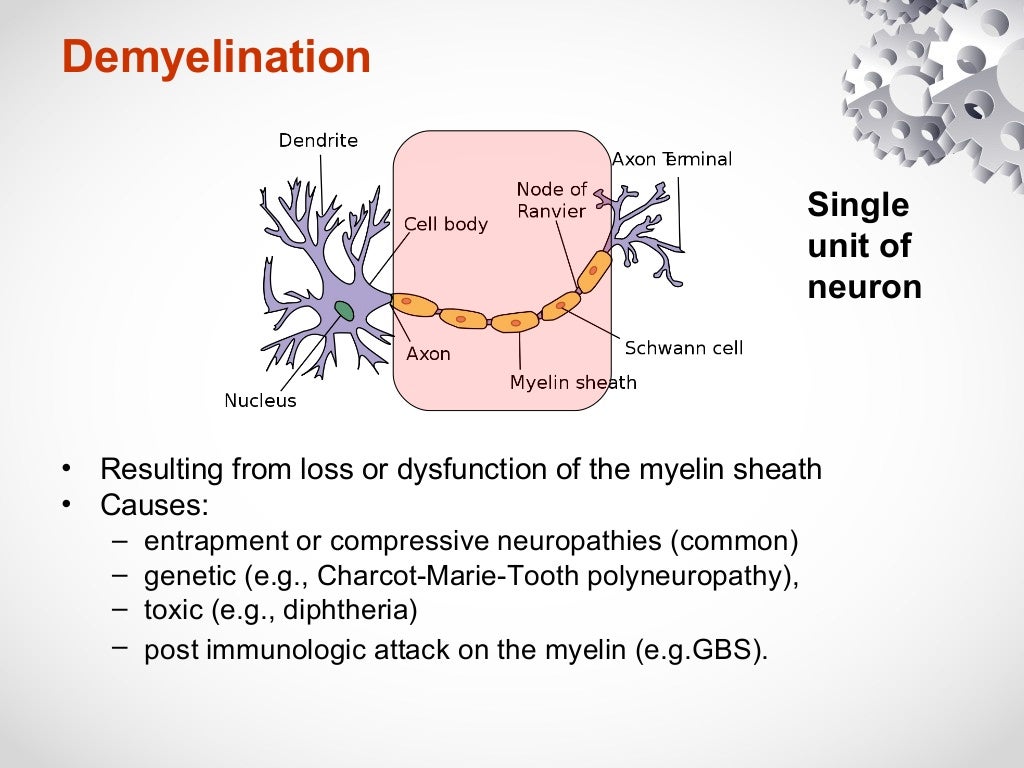 Nerves conduction study, Axonal loss vs Demyelination