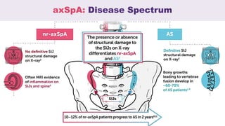 AxSpa Or CPP pdf AxSpa Or CPP pdf