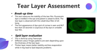 Contact lens pre fitting evaluation and Examination | PDF