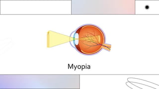 Clinical refraction...2024 Ayan Das learn | PDF