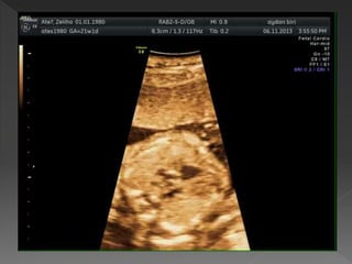 TEMEL FETAL KARDİYAK İNCELEME 