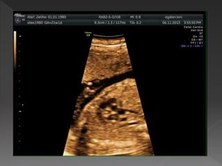 TEMEL FETAL KARDİYAK İNCELEME 