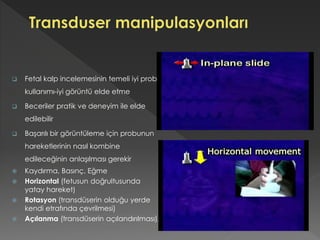  Fetal kalp incelemesinin temeli iyi prob
kullanımı-iyi görüntü elde etme
 Beceriler pratik ve deneyim ile elde
edilebilir
 Başarılı bir görüntüleme için probunun
hareketlerinin nasıl kombine
edileceğinin anlaşılması gerekir
 Kaydırma, Basınç, Eğme
 Horizontal (fetusun doğrultusunda
yatay hareket)
 Rotasyon (transdüserin olduğu yerde
kendi etrafında çevrilmesi)
 Açılanma (transdüserin açılandırılması),.
 