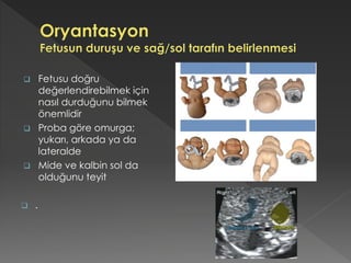  Fetusu doğru
değerlendirebilmek için
nasıl durduğunu bilmek
önemlidir
 Proba göre omurga;
yukarı, arkada ya da
lateralde
 Mide ve kalbin sol da
olduğunu teyit
 .
 