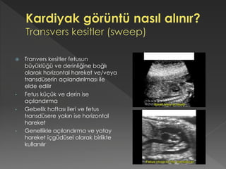  Tranvers kesitler fetusun
büyüklüğü ve derinliğine bağlı
olarak horizontal hareket ve/veya
transdüserin açılandırılması ile
elde edilir
• Fetus küçük ve derin ise
açılandırma
• Gebelik haftası ileri ve fetus
transdüsere yakın ise horizontal
hareket
• Genellikle açılandırma ve yatay
hareket içgüdüsel olarak birlikte
kullanılır
 