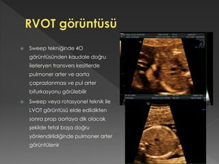  Sweep tekniğinde 4O
görüntüsünden kaudale doğru
ilerleryen transvers kesitlerde
pulmoner arter ve aorta
çaprazlanması ve pul arter
bifurkasyonu görülebilir
 Sweep veya rotasyonel teknik ile
LVOT görüntüsü elde edildikten
sonra prop aortaya dik olacak
şekilde fetal başa doğru
yönlendirildiğinde pulmoner arter
görüntülenir
 