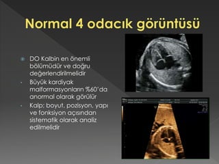  DO Kalbin en önemli
bölümüdür ve doğru
değerlendirilmelidir
• Büyük kardiyak
malformasyonların %60’da
anormal olarak görülür
• Kalp; boyut, pozisyon, yapı
ve fonksiyon açısından
sistematik olarak analiz
edilmelidir
 