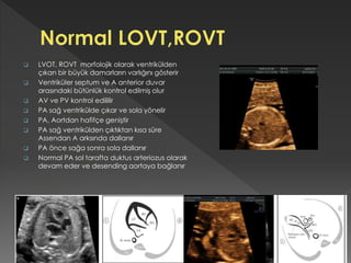  LVOT, ROVT morfolojik olarak ventrikülden
çıkan bir büyük damarların varlığını gösterir
 Ventriküler septum ve A anterior duvar
arasındaki bütünlük kontrol edilmiş olur
 AV ve PV kontrol edililir
 PA sağ ventrikülde çıkar ve sola yönelir
 PA, Aortdan hafifçe geniştir
 PA sağ ventrikülden çıktıktan kısa süre
Assendan A arksında dallanır
 PA önce sağa sonra sola dallanır
 Normal PA sol tarafta duktus arteriozus olarak
devam eder ve desending aortaya bağlanır
 