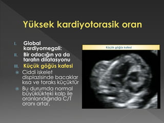 I. Global
kardiyomegali:
II. Bir odacığın ya da
tarafın dilatasyonu
III. Küçük göğüs kafesi
 Ciddi iskelet
displazisinde bacaklar
kısa ve toraks küçüktür
 Bu durumda normal
büyüklükteki kalp ile
oranlandığında C/T
oranı artar.
Küçük göğüs kafesi
 