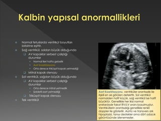  Normal fetuslarda ventrikül boyutları
birbirine eşittir.
 Sağ ventrikül, soldan büyük olduğunda
 AV kapaklar serbest çalıştığı
durumlar
 Normal ileri hafta gebelik
 Aort koarktasyonu
 Orta derece triküspit kapak yetmezliği
 Mitral kapak stenozu
 Sol ventrikül, sağdan büyük olduğunda
 AV kapaklar serbest çalıştığı
durumlar
 Orta derece mitral yetmezlik
 Şiddetli aort yetmezliği
 Triküspit kapak stenozu
 Tek ventrikül
Aort Koarktasyonu, ventriküler orantısızlık ile
ilişkili en sık görülen defekttir. Sol ventrikül
normalden hafif küçük, sağ ventrikül ise hafif
büyüktür. Genellikle her ikisi normal
sınırlardadır fakat RV/LV oranı bozulmuştur.
Ventriküllerin orantısızlığı genellikle renkli
doppler ile gösterilir. Aorta ve transvers ark
hipoplazisi, tanıyı destekler ama dört odacık
görüntüsünde izlenemezler.
 
