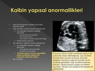 Normal fetuslarda ventrikül boyutları
birbirine eşittir.
 Sağ ventrikül, soldan büyük olduğunda
 AV kapaklar serbest çalıştığı
durumlar
 Normal ileri hafta gebelik
 Aort koarktasyonu
 Orta derece triküspit kapak yetmezliği
 Mitral kapak stenozu
 Sol ventrikül, sağdan büyük olduğunda
 AV kapaklar serbest çalıştığı
durumlar
 Orta derece mitral yetmezlik
 Şiddetli aort yetmezliği
 Triküspit kapak stenozu (genellikle
intakt ventriküler septum ile
pulmoner atrezi bir arada)
 Tek ventrikül
Pulmoner atrezi. İntakt ventriküler septum ile
pulmoner atrezi birlikteliğinde, sağ ventrikül
kavitesi kalın duvarlı ve küçük, boyutlar
değişken olmasına rağmen burada her iki
örnekde görülebilir. Sağ ventrikül kasılması
kötüdür. Triküpit kapak açıklığı normalden
küçüktür. Triküspit yetmezliği renkli doppler ile
gösterilebilir.
 