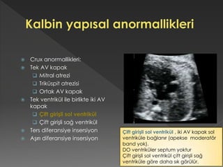 Crux anormallikleri:
 Tek AV kapak
 Mitral atrezi
 Triküspit atrezisi
 Ortak AV kapak
 Tek ventrikül ile birlikte iki AV
kapak
 Çift girişli sol ventrikül
 Çift girişli sağ ventrikül
 Ters diferansiye insersiyon
 Aşırı diferansiye insersiyon
Çift girişli sol ventrikül , iki AV kapak sol
ventriküle bağlanır (apekse moderatör
band yok).
DO ventriküler septum yoktur
Çift girişli sol ventrikül çift girişli sağ
ventriküle göre daha sık görülür.
 