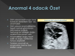  Dört odacık kesiti major fetal
kardiyak defektlerin %60 ‘da
anormaldir.
 Dört odacık anormalliklerinin
tespiti normal görüntünün
bilinmesine bağlıdır,
herhangi bir farklılığın doğru
açıklanması şansını verir.
 Anormallikler doğru tespit
edilir ve doğru tariflenirse
tanıya ulaşılabilir.
 Tanıların anomali ve
prognozları üzerine özel
etkileri vardır.
Anormal dört odacık görüntüleri
 