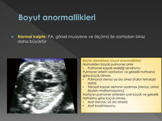  Normal kalpte: PA, görsel muayene ve ölçümü ile aortadan biraz
daha büyüktür
Büyük damarların boyut anormallikleri:
Normalden büyük pulmoner arter
• Pulmoner kapak eksikliği sendromu
Pulmoner arterin aortadan ve gebelik haftasına
göre küçük olması.
• Pulmonar stenoz ya da atrezi (Fallot tetralojisi
dahil)
• Triküspit kapak akımının azalması (stenoz, atrezi,
Ebstein malformasyonu)
Aortanın pulmoner arterden çok küçük ve gebelik
haftasına göre küçük olması.
• Aort stenozu ya da atrezisi
• Aort koarktasyonu
 