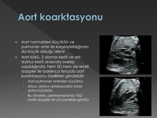  Aort normalden küçüktür ve
pulmoner arter ile karşılaştırıldığında
da küçük olduğu izlenir
 Aort kökü, 3 damar kesiti ve ark-
duktus kesiti arasında sweep
yapıldığında, hem 2D hem de renkli
doppler ile bakılınca fetusda aort
koarktasyonu özellikleri görülebilir:
• Aort pulmoner arterden küçüktür.
• Arkus, duktus arteriozusdan biraz
daha küçüktür.
• Bu örnekte, perimembranöz VSD
renkli doppler ile üst panelde görülür
 