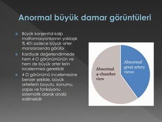 Büyük konjenital kalp
malformasyonlarının yaklaşık
% 40'ı sadece büyük arter
manzarasında görülür
 Kardiyak değerlendirmede
hem 4 O görünümünün ve
hem de büyük arter lerin
incelenmesi gereklidir
 4 O görünümü incelemesine
benzer şekilde, büyük
arterlerin boyutu, konumu,
yapısı ve fonksiyonu
sistematik olarak analiz
edilmelidir
 