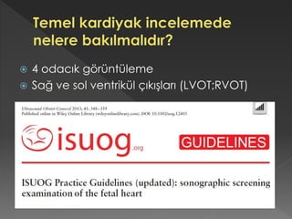  4 odacık görüntüleme
 Sağ ve sol ventrikül çıkışları (LVOT;RVOT)
 