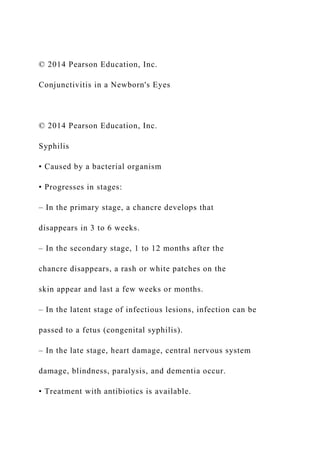 © 2014 Pearson Education, Inc.
Conjunctivitis in a Newborn's Eyes
© 2014 Pearson Education, Inc.
Syphilis
• Caused by a bacterial organism
• Progresses in stages:
– In the primary stage, a chancre develops that
disappears in 3 to 6 weeks.
– In the secondary stage, 1 to 12 months after the
chancre disappears, a rash or white patches on the
skin appear and last a few weeks or months.
– In the latent stage of infectious lesions, infection can be
passed to a fetus (congenital syphilis).
– In the late stage, heart damage, central nervous system
damage, blindness, paralysis, and dementia occur.
• Treatment with antibiotics is available.
 