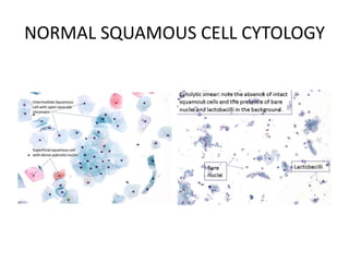 NORMAL SQUAMOUS CELL CYTOLOGY
 