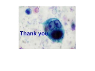 ROLE_OF_CERVICAL_CYTOLOGY_IN_SCREENING.pptx