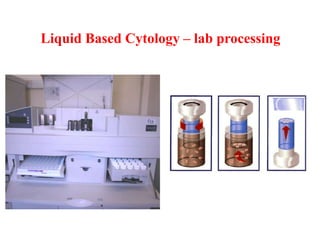 Liquid Based Cytology – lab processing
 