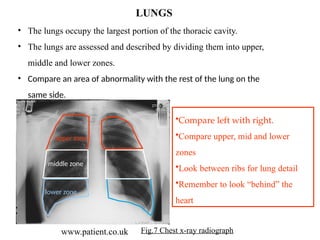 How to interpret the chest x- ray.. .pptx