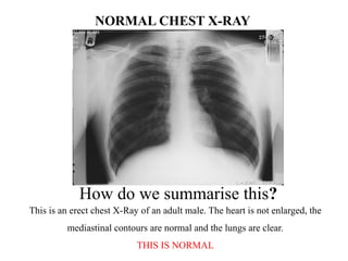 How to interpret the chest x- ray.. .pptx