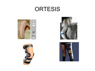 ORTESIS
 