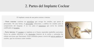 2. Partes del Implante Coclear
El implante consta de una parte externa e interna:
- Parte externa: contiene un micrófono que recoge los sonidos, que pasan al
procesador. De esta forma, el procesador selecciona y codifica los sonidos para la
comprensión del lenguaje. A su vez, pasa al transmisor que envía los sonidos
codificados al receptor.
- Parte interna: El receptor se implanta en el hueso mastoides (pabellón auricular).
Envía las señales eléctricas a los electrodos (interior de la cóclea y estimulan las
células nerviosas que funcionan). Estos estímulos pasan a través del nervio auditivo al
cerebro, que los reconoce como sonidos.
 