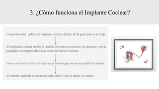 3. ¿Cómo funciona el Implante Coclear?
Un profesional coloca el implante coclear debajo de la piel junto a la oreja.
El implante coclear recibe el sonido del entorno exterior, lo procesa y envía
pequeñas corrientes eléctricas cerca del nervio coclear.
Estas corrientes eléctricas activan el nervio que envía una señal al cerebro.
El cerebro aprende a reconocer esta señal y por lo tanto, el sonido.
 