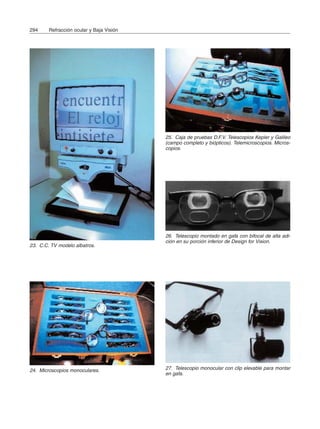 294 Refracción ocular y Baja Visión
25. Caja de pruebas D.F.V. Telescopios Kepler y Galileo
(campo completo y biópticos). Telemicroscopios. Micros-
copios.
27. Telescopio monocular con clip elevable para montar
en gafa.
26. Telescopio montado en gafa con bifocal de alta adi-
ción en su porción inferior de Design for Vision.
23. C.C. TV modelo albatros.
24. Microscopios monoculares.
 