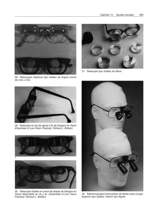 Capítulo 14. Ayudas visuales 295
29. Telescopio en ojo de águila 2,2x de Designs for Vision
(Essentials of Low Vision Practice). Richard L. Brilliant.
31. Telescopio tipo Galileo de Nikon.
30. Telescopio Galileo en panal de abejas de Designs for
Vision disponibles en 3x y 4x. (Essentials of Low Vision
Practice). Richard L. Brilliant.
32. Telemicroscopios binoculares de Keeler para cirugía.
Superior tipo Galileo. Inferior tipo Kepler.
28. Telescopios biópticos tipo Galileo de ángulo ancho
de 2,2x y 3,0x.
 