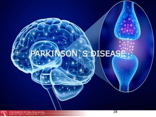 28
PARKINSON`S DISEASE
 