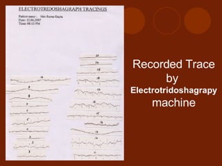 Ayurscan: Electrotridoshagraphy {ETG} Report