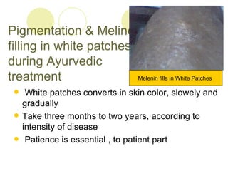 Pigmentation & Meline filling in white patches during Ayurvedic treatment ,[object Object],[object Object],[object Object],Melenin fills in White Patches  
