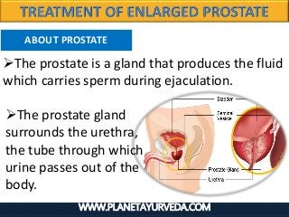 WWW.PLANETAYURVEDA.COM
ABOUT PROSTATE
The prostate gland
surrounds the urethra,
the tube through which
urine passes out of the
body.
The prostate is a gland that produces the fluid
which carries sperm during ejaculation.
 