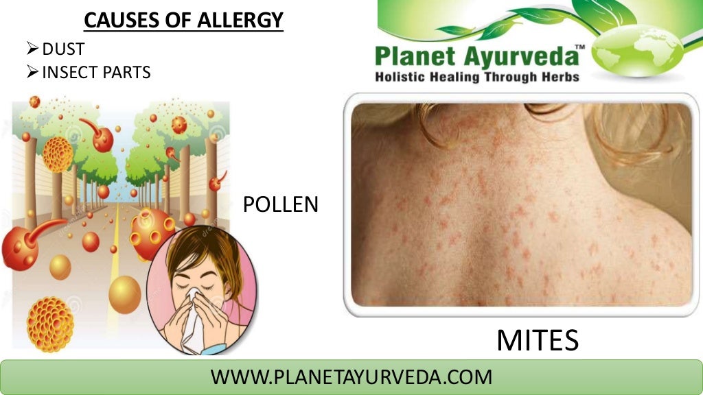 Ayurvedic medicine for allergy Natural Herbs