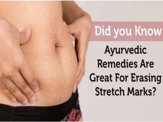 Ayurvedic Remedies to Reduce Pregnancy Stretch Mark etc