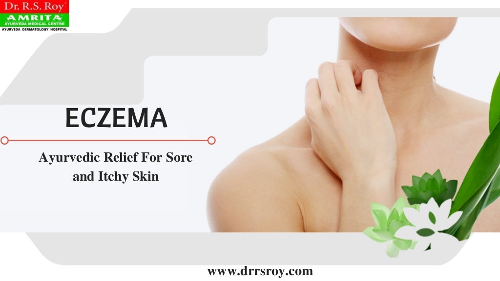 Ayurvedic Treatment For Eczema In Kochi Ayurvedic Skin Hospital In Kerala