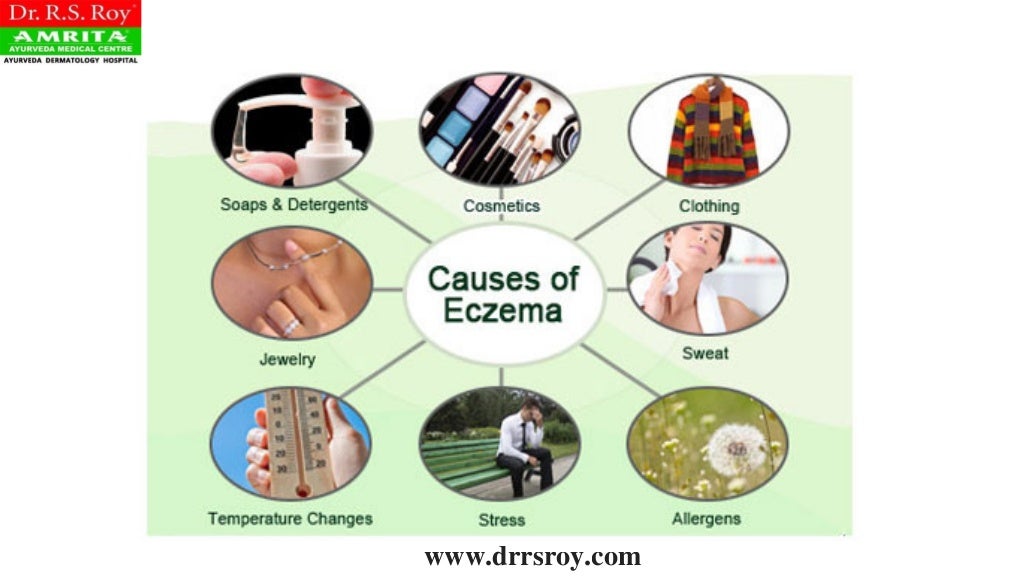 Ayurvedic Treatment For Eczema In Kochi Ayurvedic Skin Hospital In Kerala