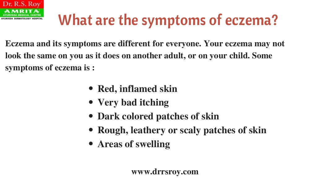 Ayurvedic Treatment For Eczema In Kochi Ayurvedic Skin Hospital In Kerala