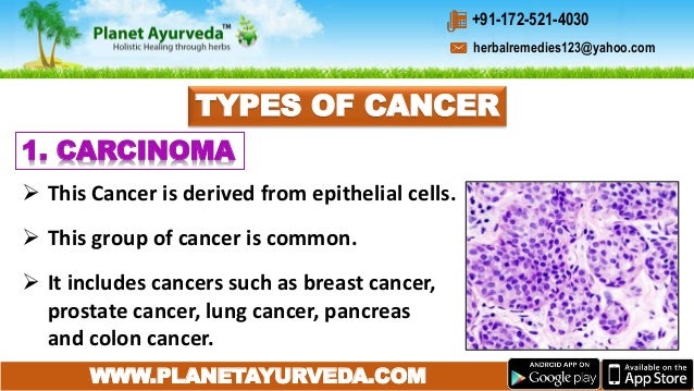 Ayurvedic Treatment Of Cancer Types Causes Symptoms Diagnosis