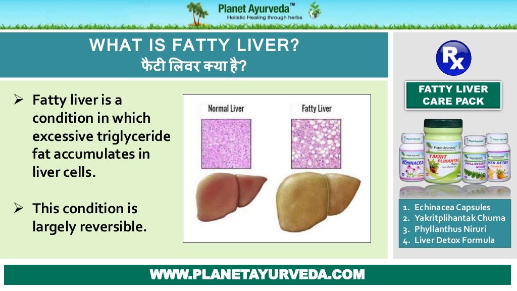 Ayurvedic Treatment for Fatty Liver Cure