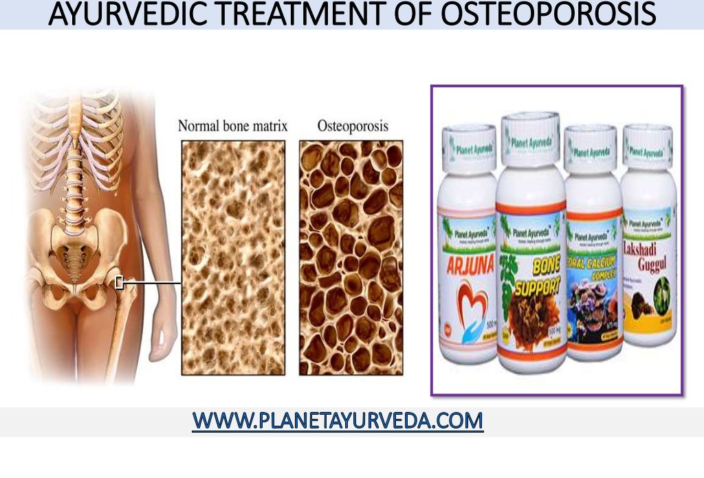 Ayurvedic treatment of osteoporosis